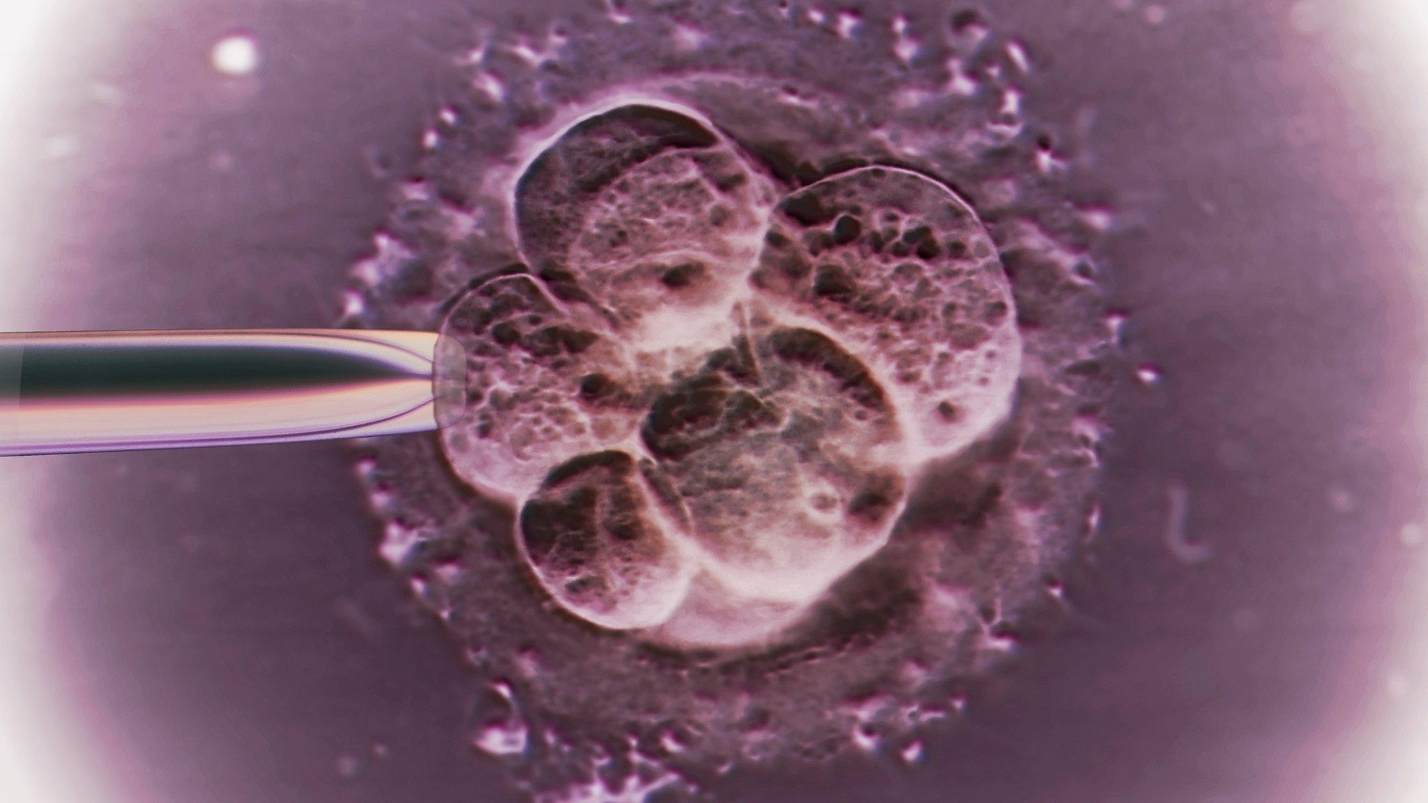 Embryo