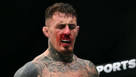 Tom Aspinall grimaces after UFC 321 in Abu Dhabi