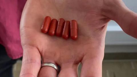 Five dark red pill capsules being held in the palm of a doctor's hand