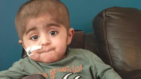 Baby Eisa is looking at the camera, with big brown eyes and dark hair, he is wearing a green jumper and has a small wire coming out of his nose.