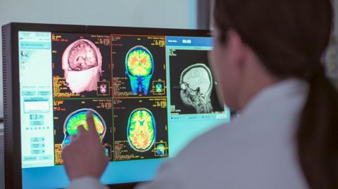 Female doctor looking at MRI scanner monitor