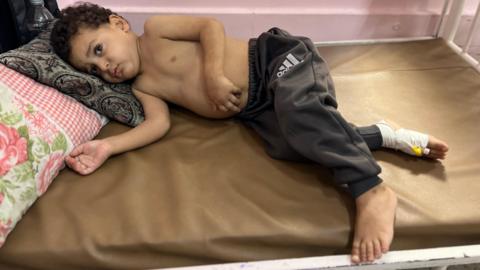 Zain Tafesh, a small Palestinian boy, laying topless on his hospital bed