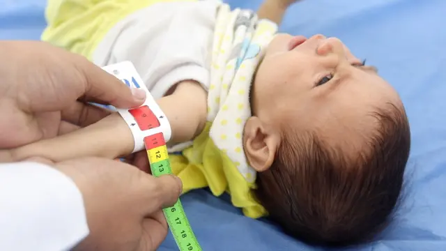 Heba, a 7-month-old baby who weighs the same as a newborn