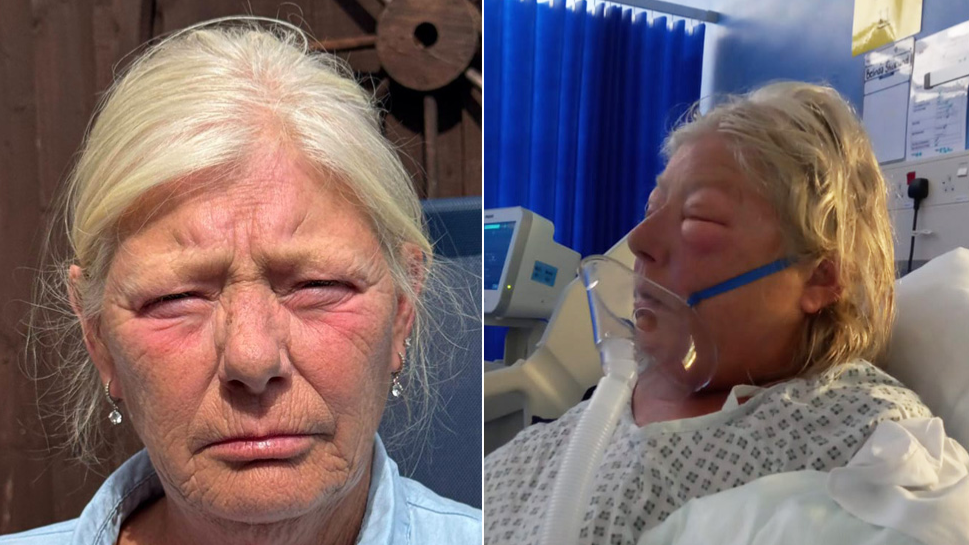 Comp image of Belinda Strickland. On the left she is staring at the camera, on the right she is in a hospital bed with a mask on