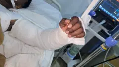 በቀዶ ሕክምና ወደ ቦታው የተመለሰው የወጣቱ እጅ