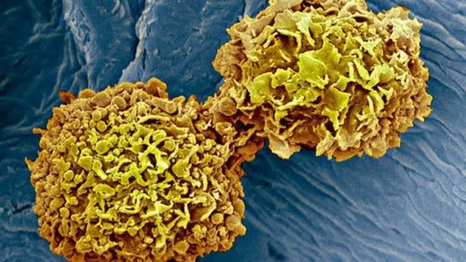 SCIENCE PHOTO LIBRARY