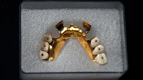 Tony Jolliffe BBC 19th Century gold dentures