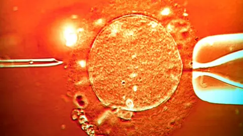 Color light micrograph of a micro-needle (left) about to inject human sperm into a human egg cell being held in place by a pipette . IVF treatment.
