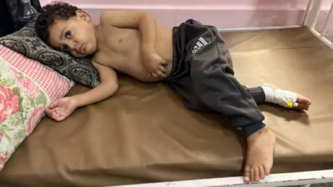 Zain Tafesh, a small Palestinian boy, laying topless on his hospital bed